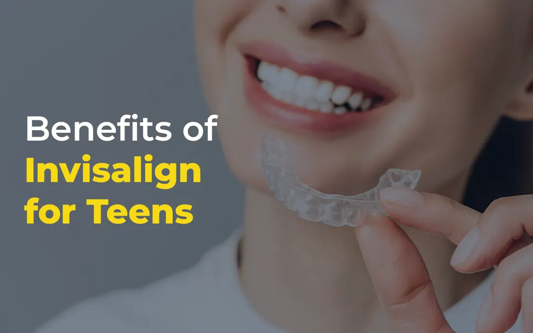 The Benefits of Invisalign for Teens