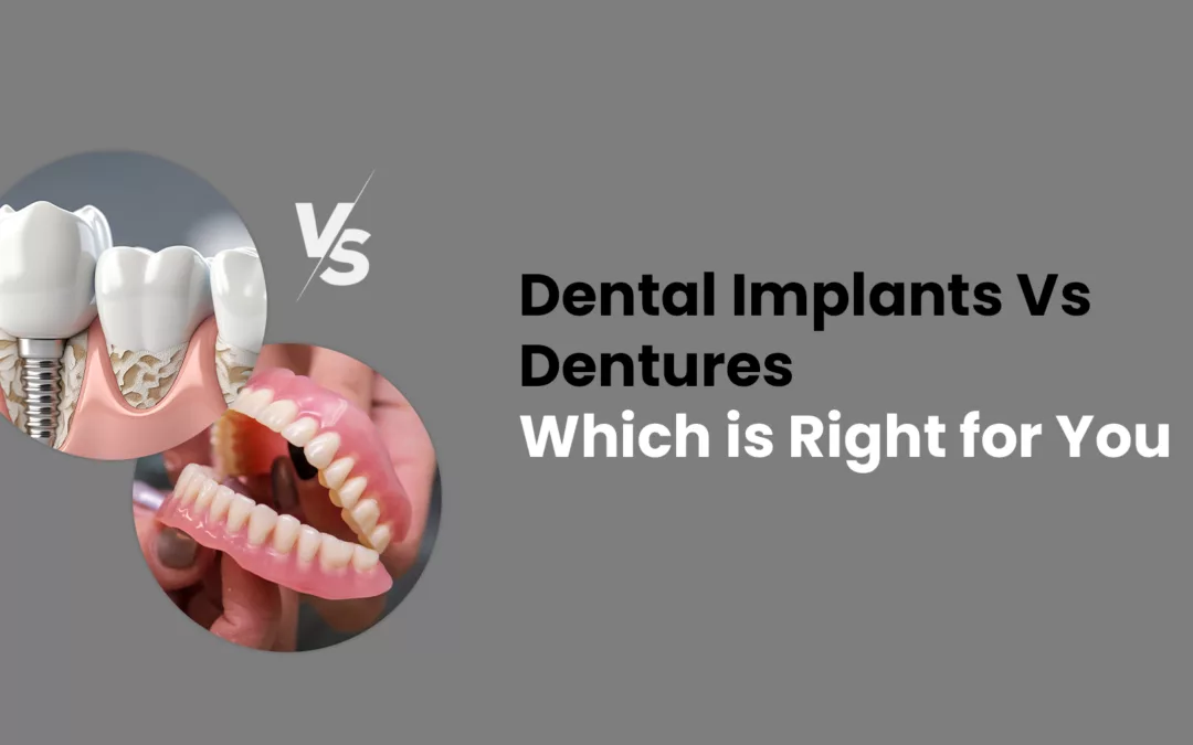 Dental Implants vs. Dentures: Which is Right for You?