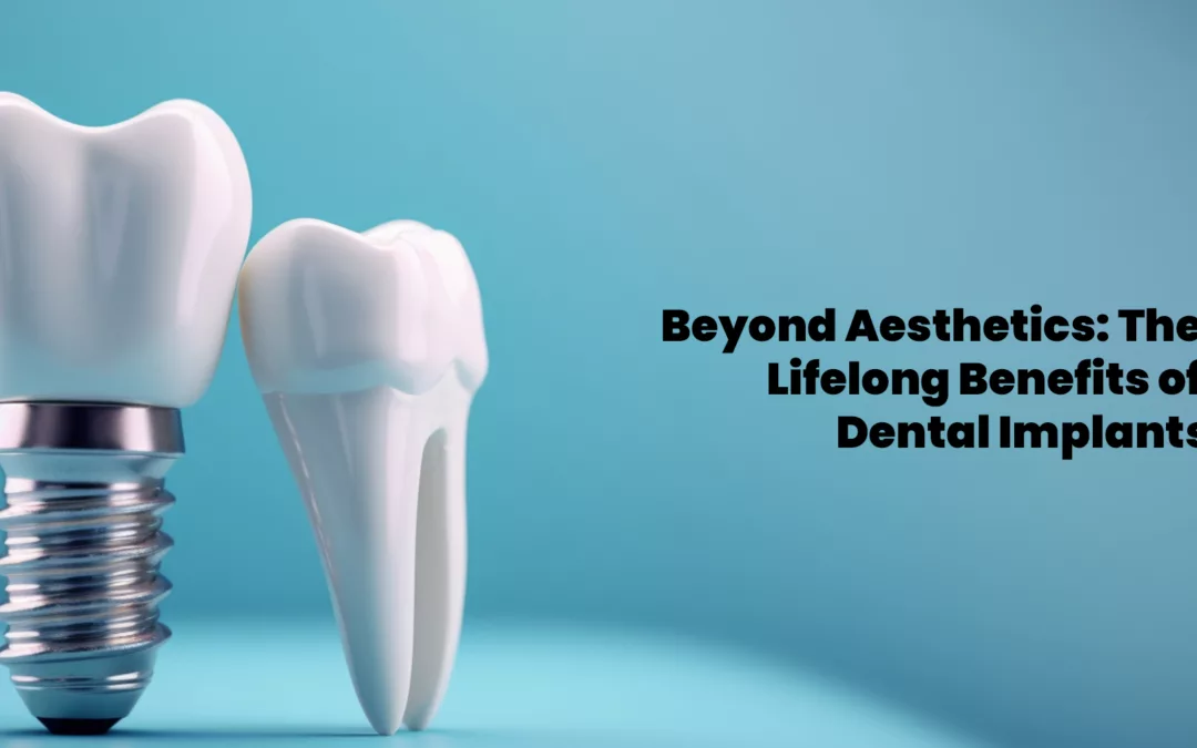 Beyond Aesthetics: The Lifelong Benefits of Dental Implants