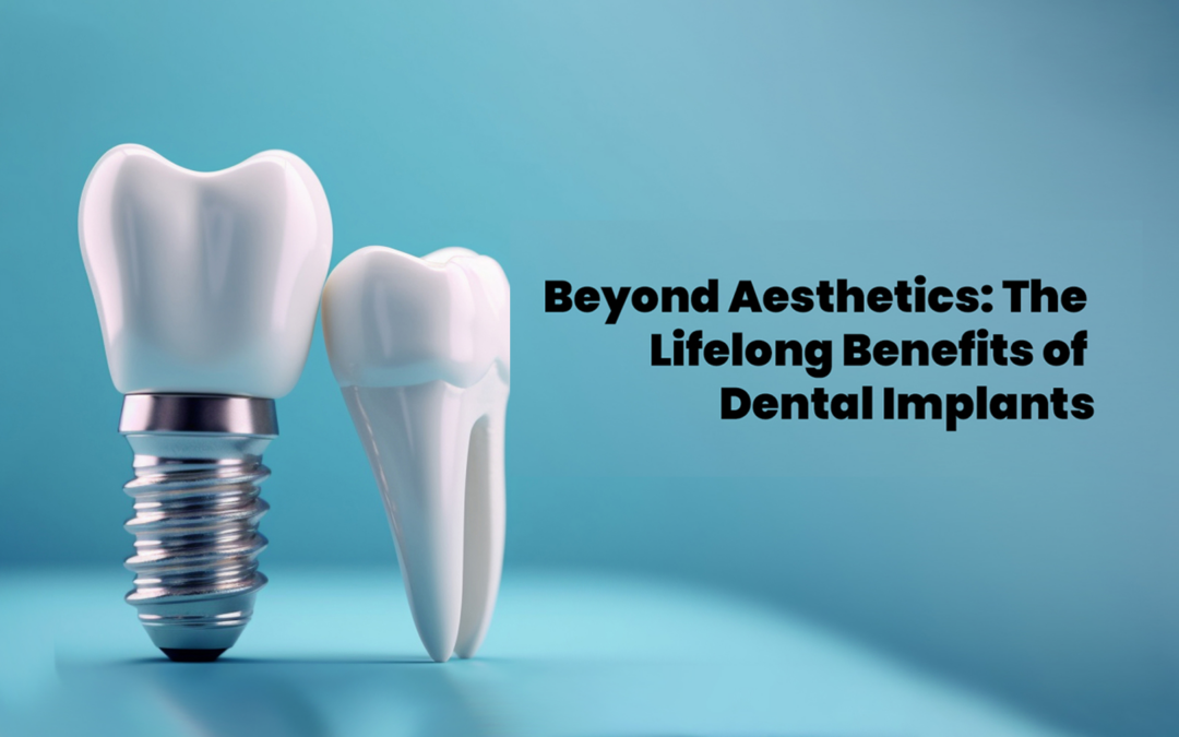 Beyond Aesthetics: The Lifelong Benefits of Dental Implants