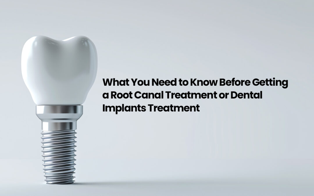 What You Need to Know Before Getting a Root Canal Treatment or Dental Implants Treatment